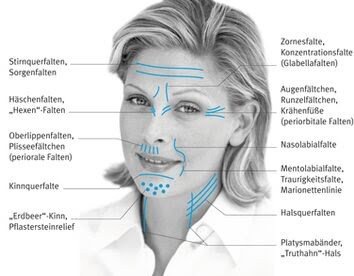 Hifu Gesichts Körper Body Straffung Behandlung
